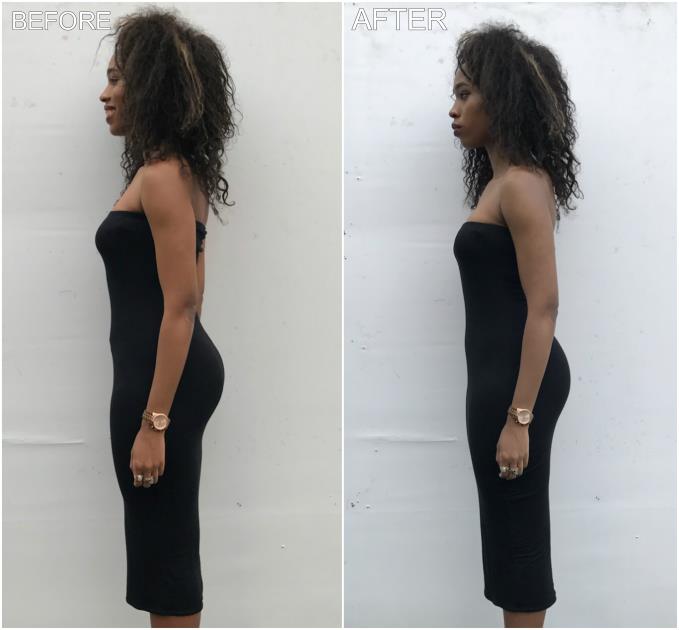 The Power of Shapewear: Before and After