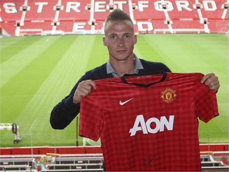 Alexander-Buttner