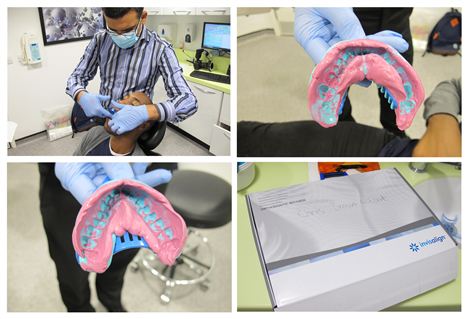 Dr Kumar Takes Moulds Of Chris' Teeth To Send To Invisalign HQ