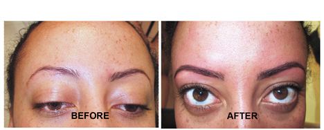 Hd Brows: Before & After