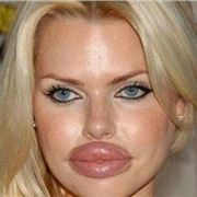 Bad Botox