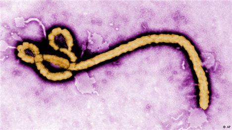 Ebola virus